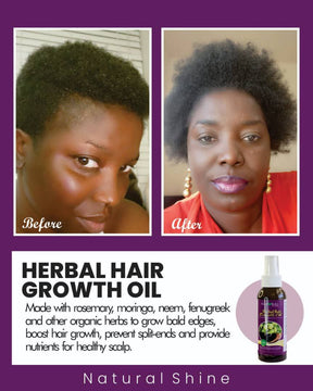 HAIR GROWTH OIL (4OZ)