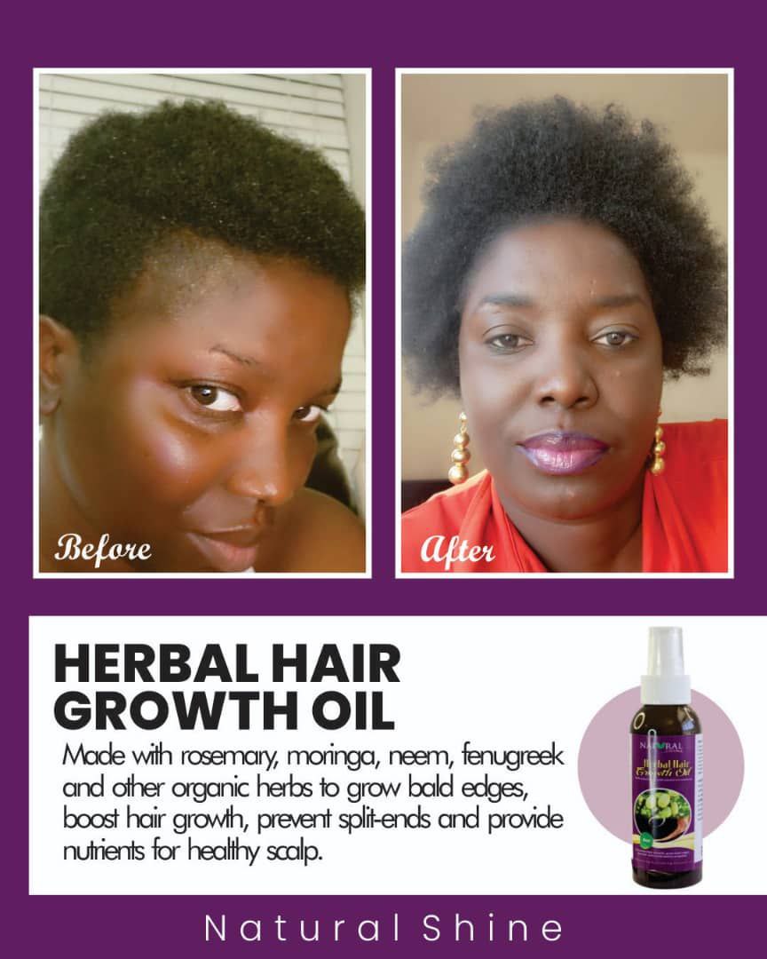 HAIR GROWTH OIL (4OZ)